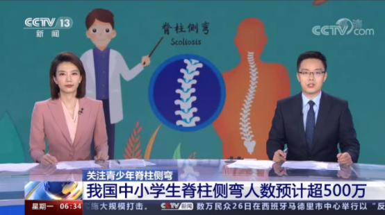 什么是青少年特发性脊柱侧弯