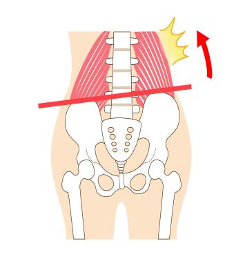 产后骨盆矫正的重要性