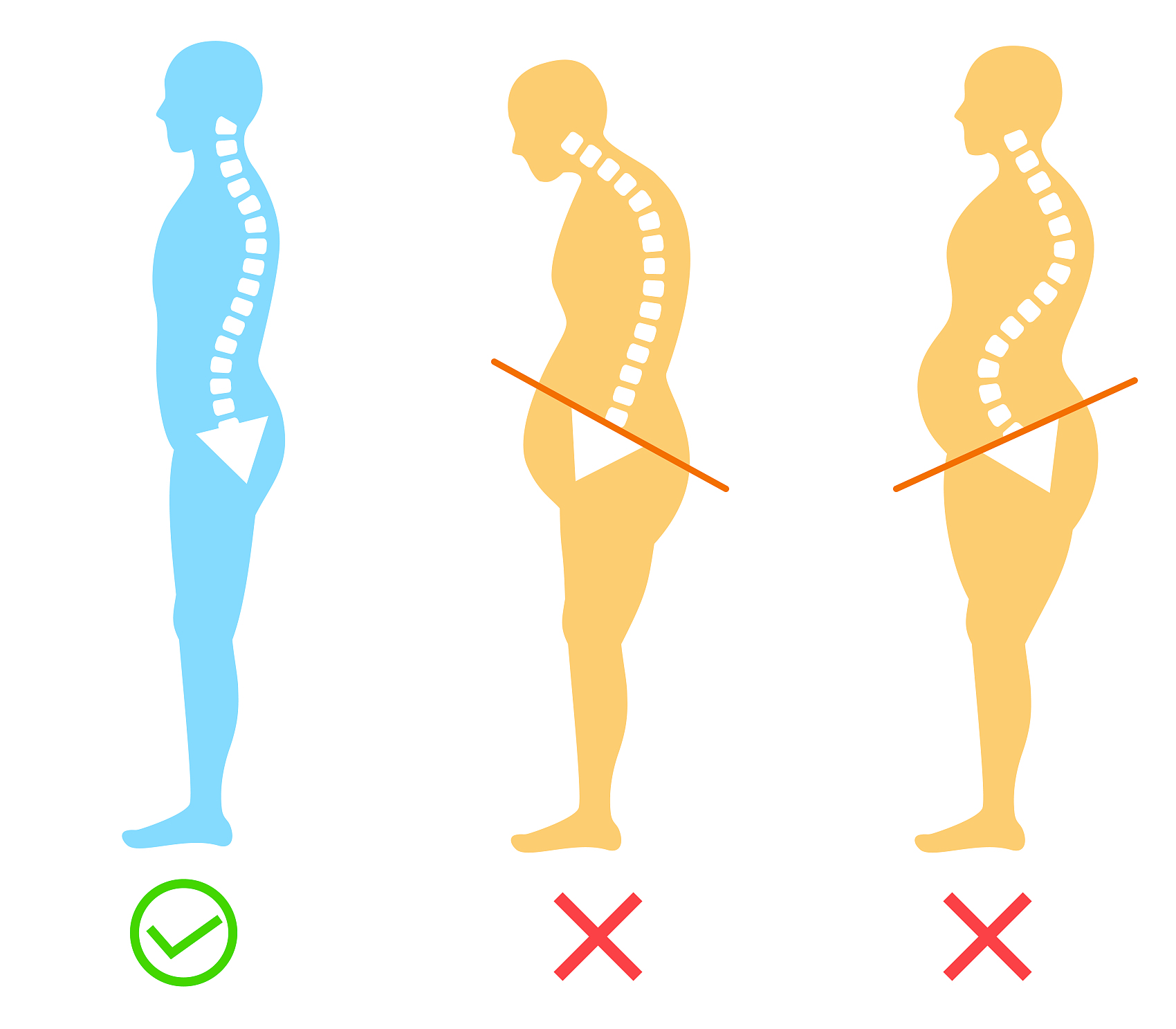 圆肩/驼背/头前引/富贵包是怎么形成的