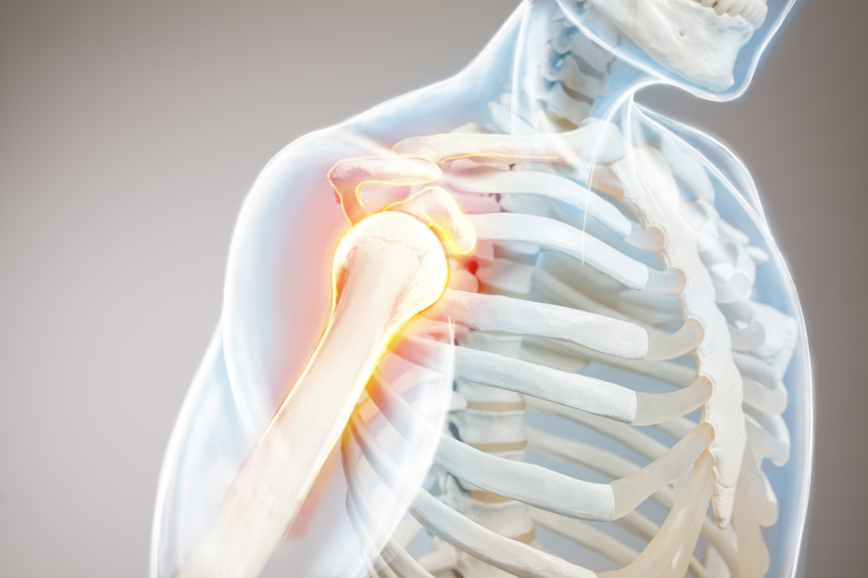 关于肌肉骨骼疼痛的 10 个问题，总有你想知道的