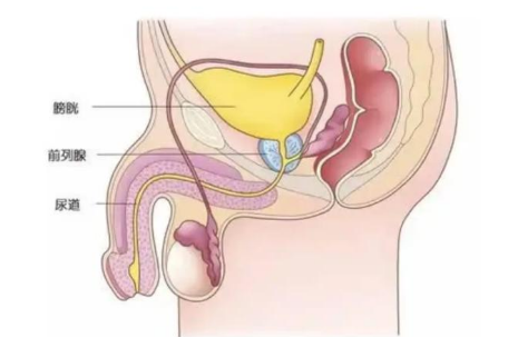 男人也做盆底康复?前列腺炎还能这么治